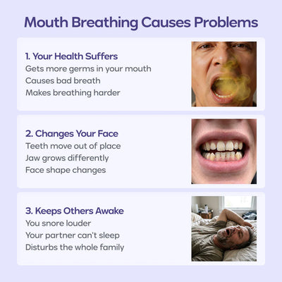 Sleep Cloud Mouth Tape